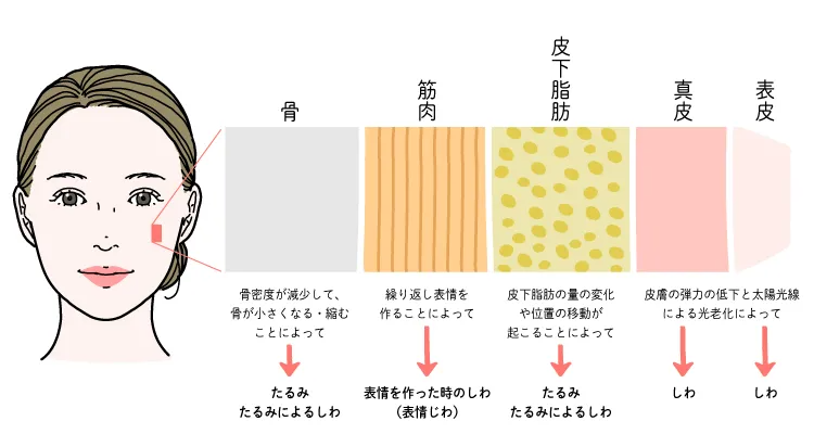 しわに影響を及ぼす顔の構造