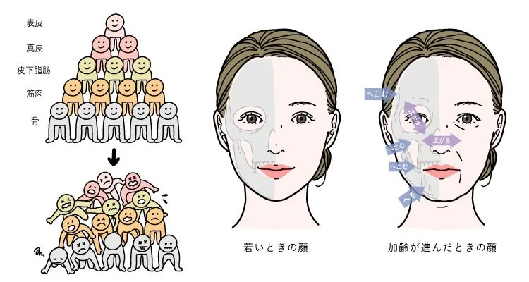 しわの原因となる骨の変化