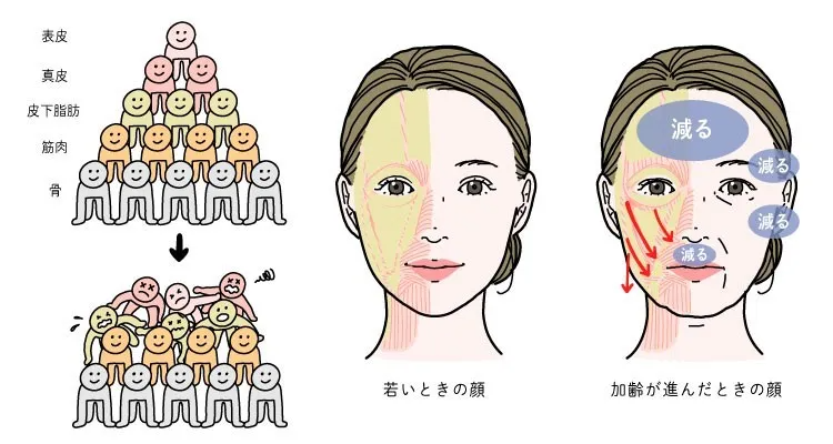 しわの原因となる皮下脂肪の変化