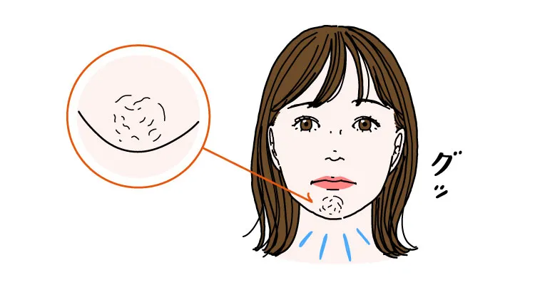 あごのしわは表情じわの一種