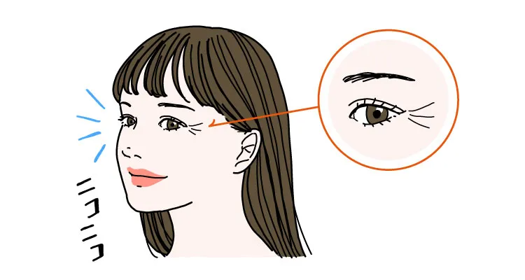 目尻のしわは表情じわの一種