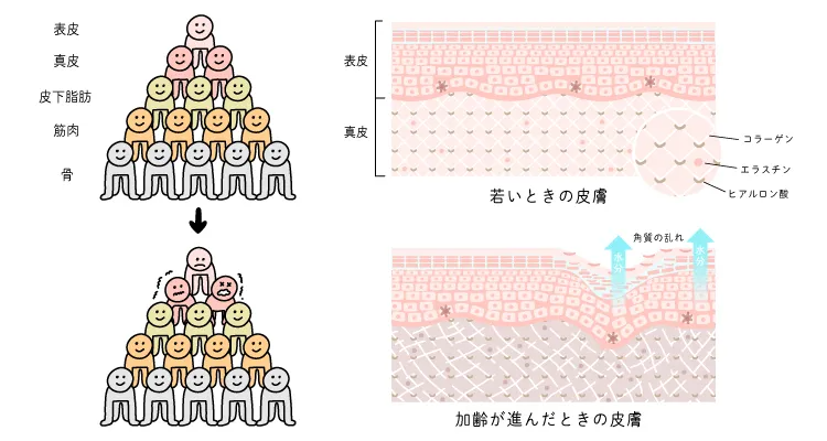 眉間のしわの原因となる真皮層の変化