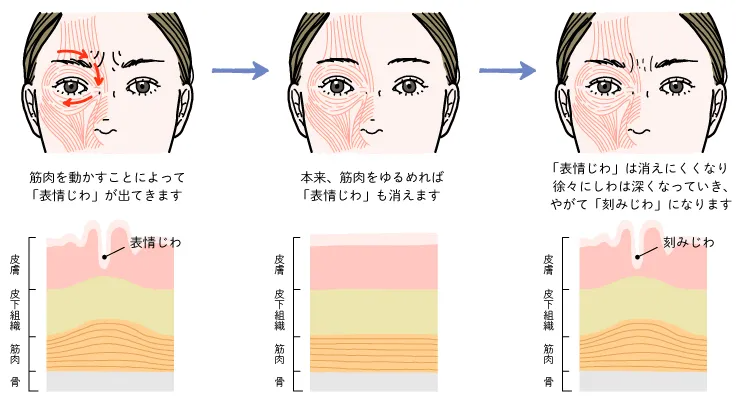 眉間のしわの形成メカニズム