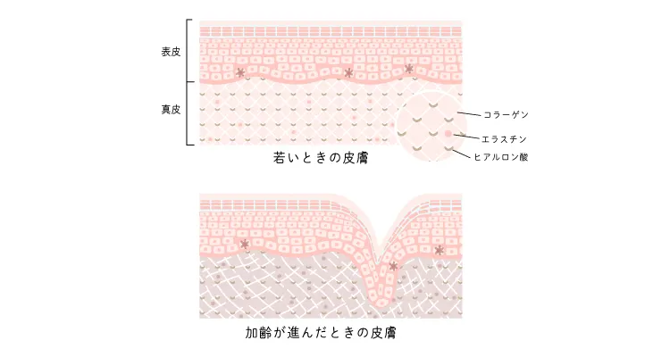 大じわの構造