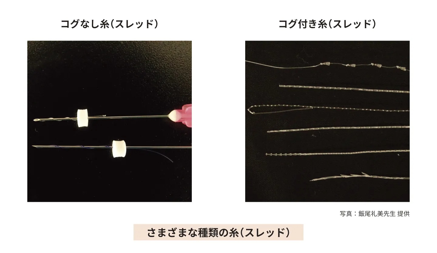 さまざまな種類の糸（スレッド）の画像