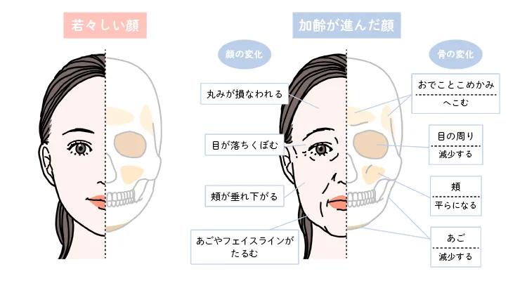 加齢の影響で生じる骨と見た目の変化